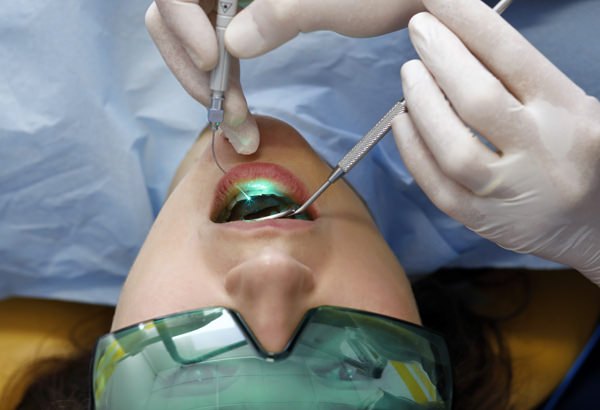 Trattamento con laser a diodi
